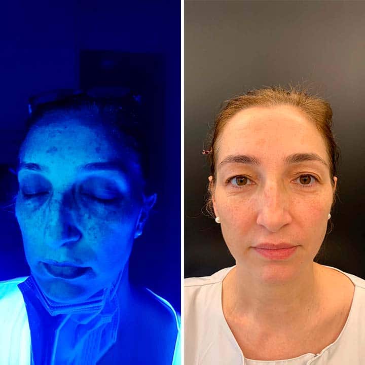 Why do you need to renew your skin?